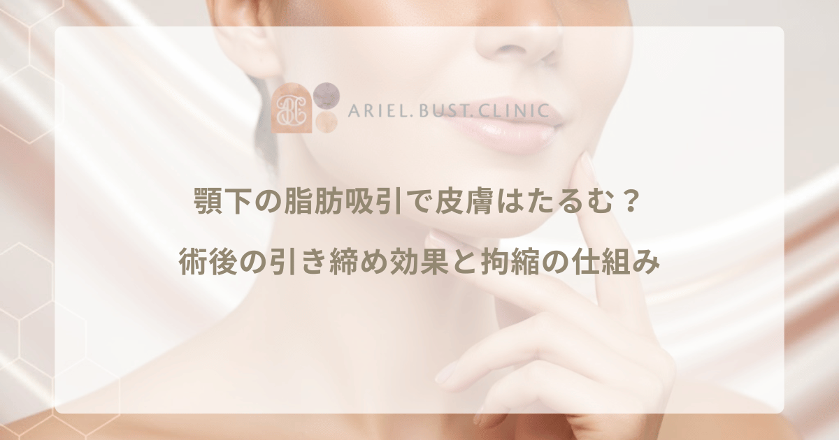 顎下の脂肪吸引で皮膚はたるむ？術後の引き締め効果と拘縮の仕組み