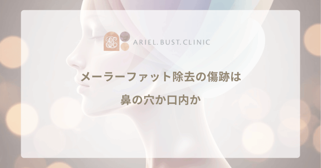 メーラーファット除去の傷跡は鼻の穴か口内か｜アプローチ法の違いと経過