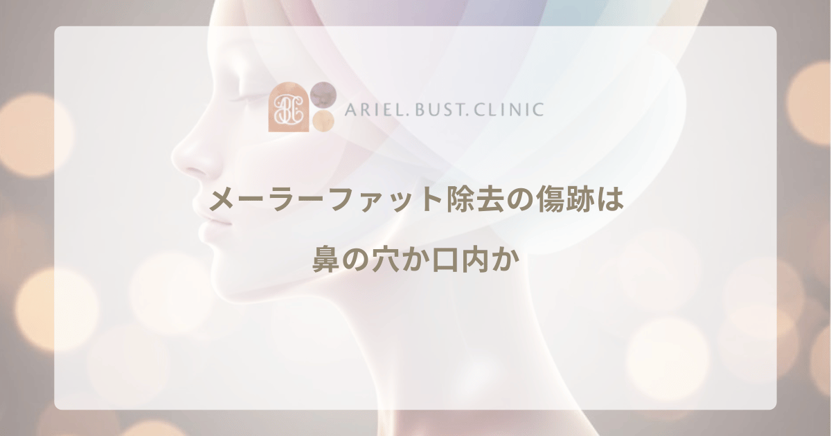 メーラーファット除去の傷跡は鼻の穴か口内か｜アプローチ法の違いと経過