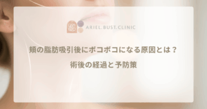 頬の脂肪吸引後にボコボコになる原因とは？術後の経過と予防策