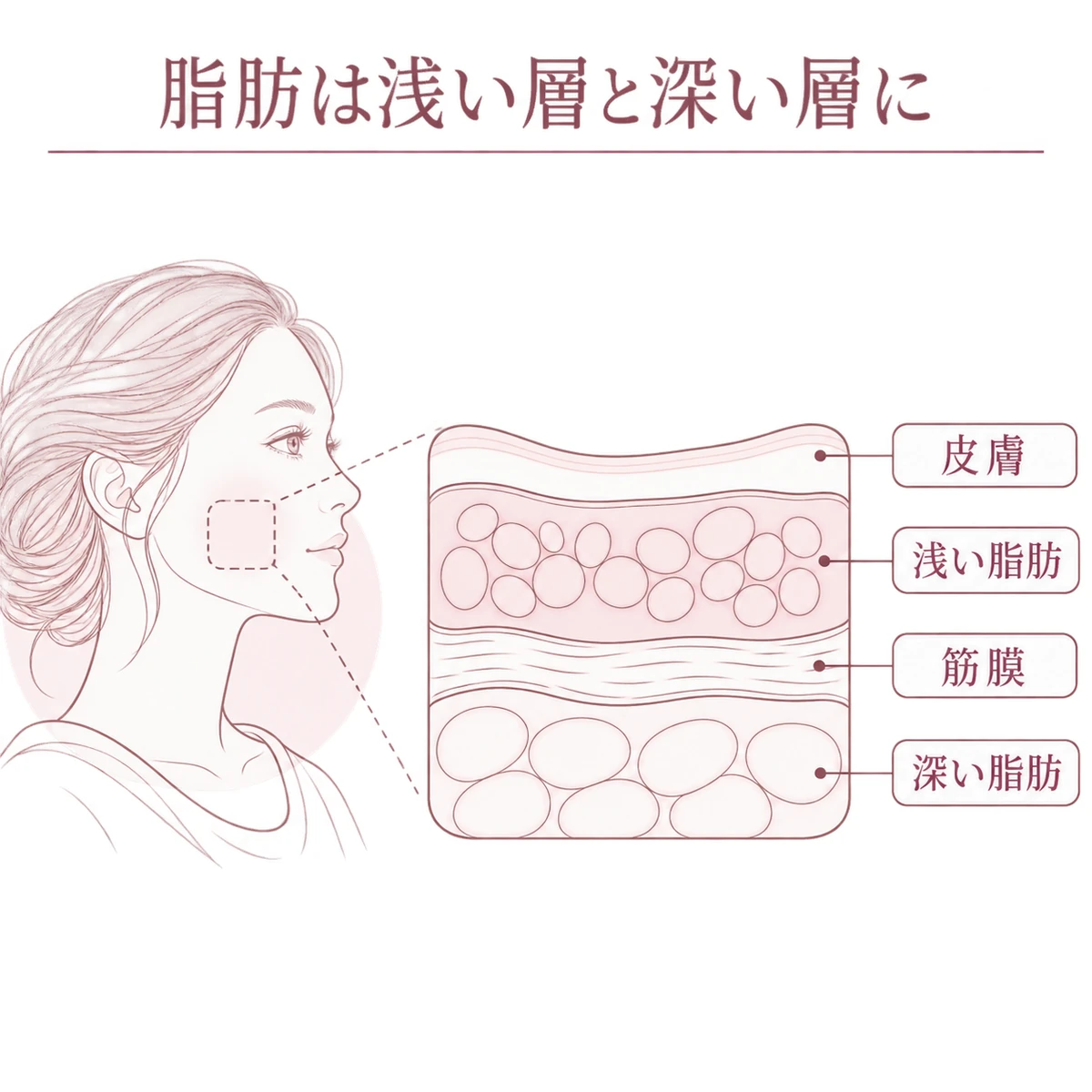 頬の皮膚の下に浅い脂肪、筋膜、深い脂肪が重なる位置関係を描いた断面模式図