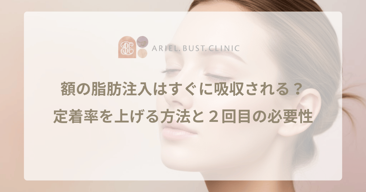 額の脂肪注入はすぐに吸収される？定着率を上げる方法と２回目の必要性