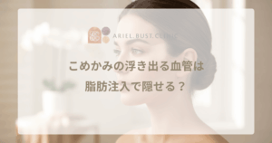 こめかみの浮き出る血管は脂肪注入で隠せる？｜皮膚の厚みを出す効果