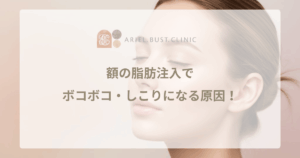 おでこの脂肪注入のデメリットとリスク！額の失敗を防ぐポイント