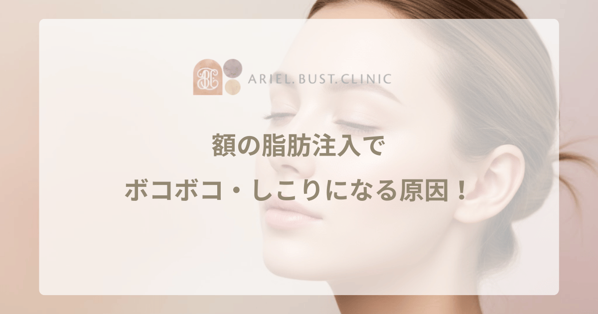 おでこの脂肪注入のデメリットとリスク！額の失敗を防ぐポイント