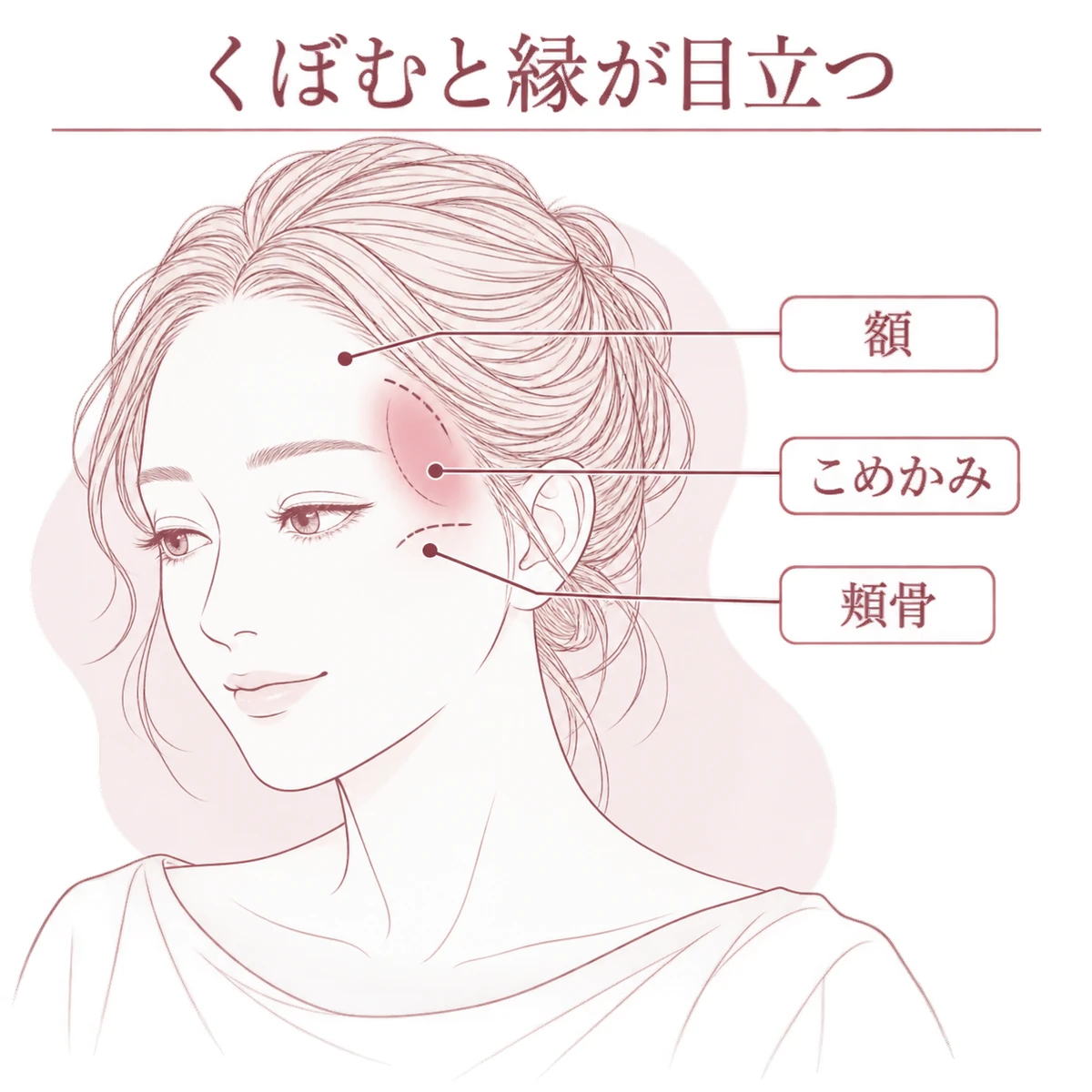 こめかみの位置と、くぼみによって額や頬骨の縁が目立つ様子を示した顔の図