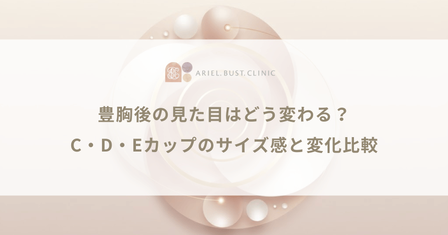 豊胸後の見た目はどう変わる?C・D・Eカップのサイズ感と変化比較