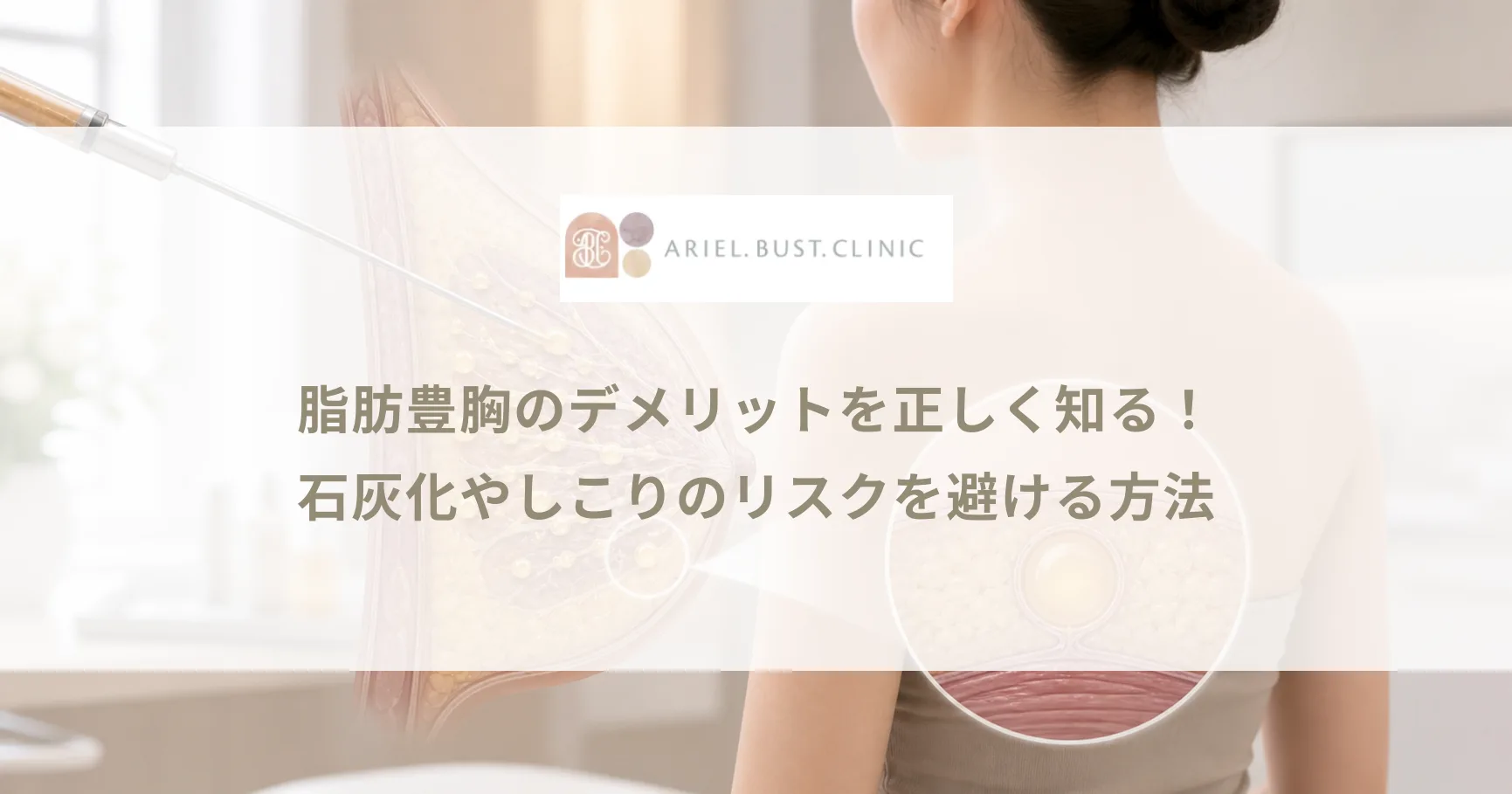 脂肪豊胸のデメリットを正しく知る！石灰化やしこりのリスクを避ける方法