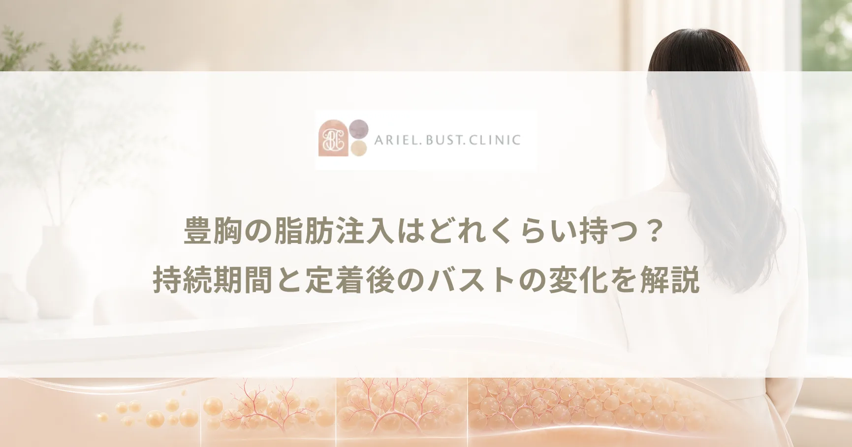 豊胸の脂肪注入はどれくらい持つ？持続期間と定着後のバストの変化を解説