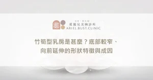 竹筍型乳房是甚麼？底部較窄、向前延伸的形狀特徵與成因